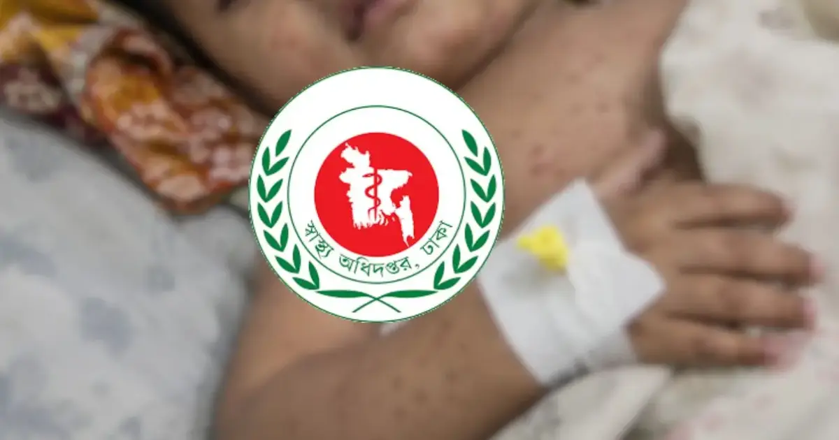 দেশে হাম-উপসর্গে আক্রান্ত হয়ে আরও এক শিশুর মৃ’ত্যু