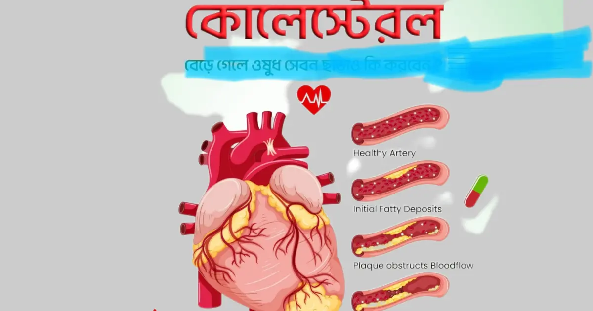 উচ্চ কোলেস্টেরল নিয়ন্ত্রণে রাখবেন যেভাবে: জেনে নিন প্রয়োজনীয় খাদ্যাভ্যাস