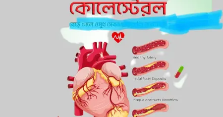 উচ্চ কোলেস্টেরল নিয়ন্ত্রণে রাখবেন যেভাবে: জেনে নিন প্রয়োজনীয় খাদ্যাভ্যাস