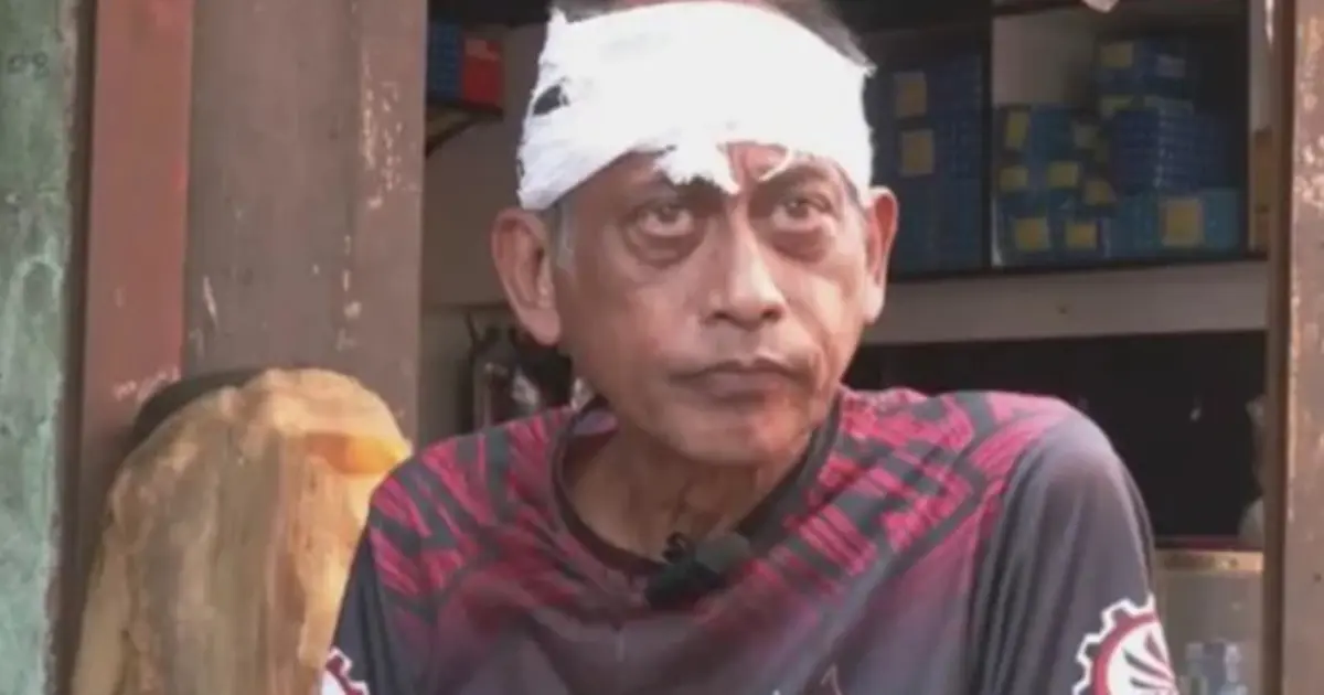 যশোরে নিজ বাড়ির সামনে হামলার শিকার অভিনেতা সমু চৌধুরী, মাথায় সেলাই